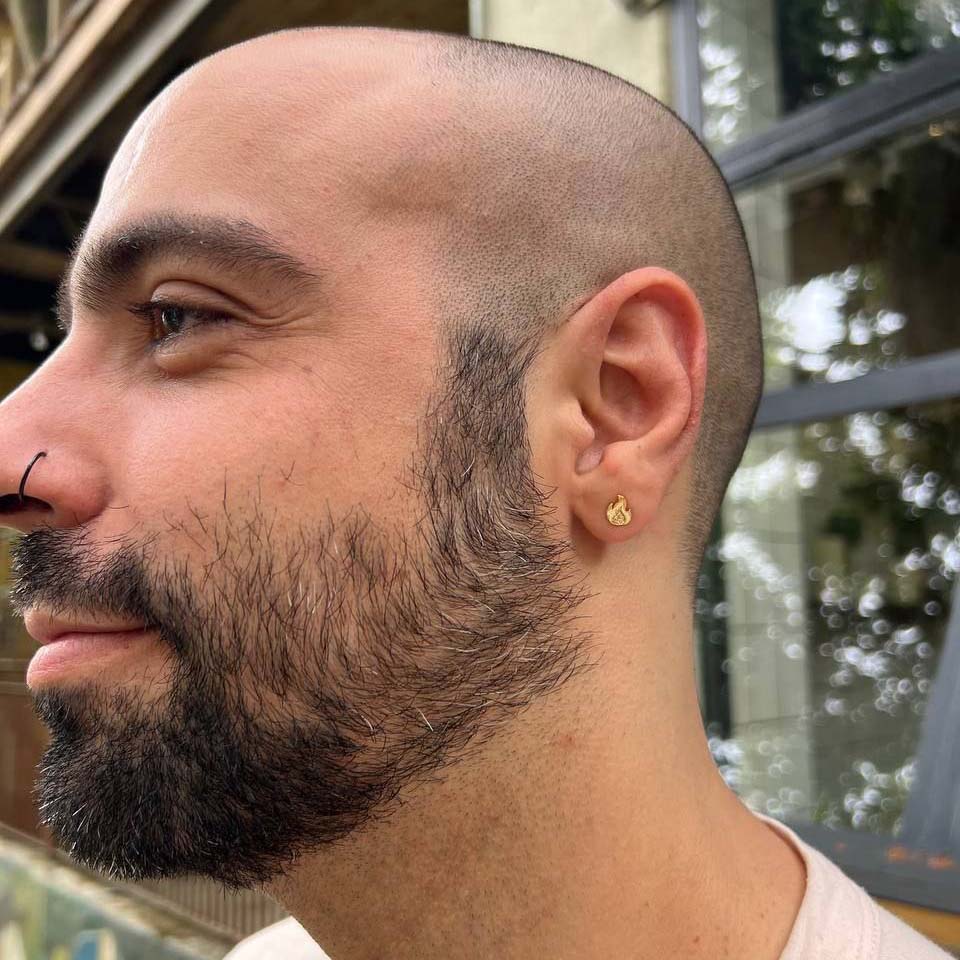 Arete On Fire